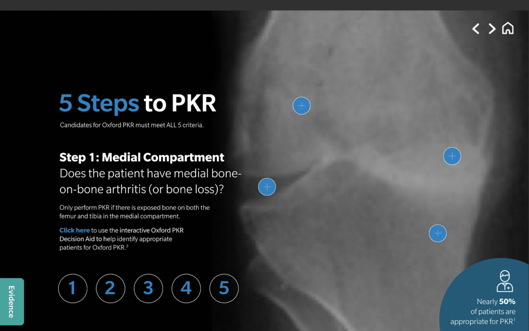 Recognise the 5 steps to identify your PKR patients